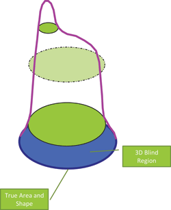 Figure 5. True area, shape and volume measurement obtained by combining 2D and 3D technology.